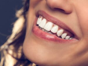 Looking For Teeth Whitening Dallas? Call Us Now (214) 352-2777   Get A White Smile Fast.