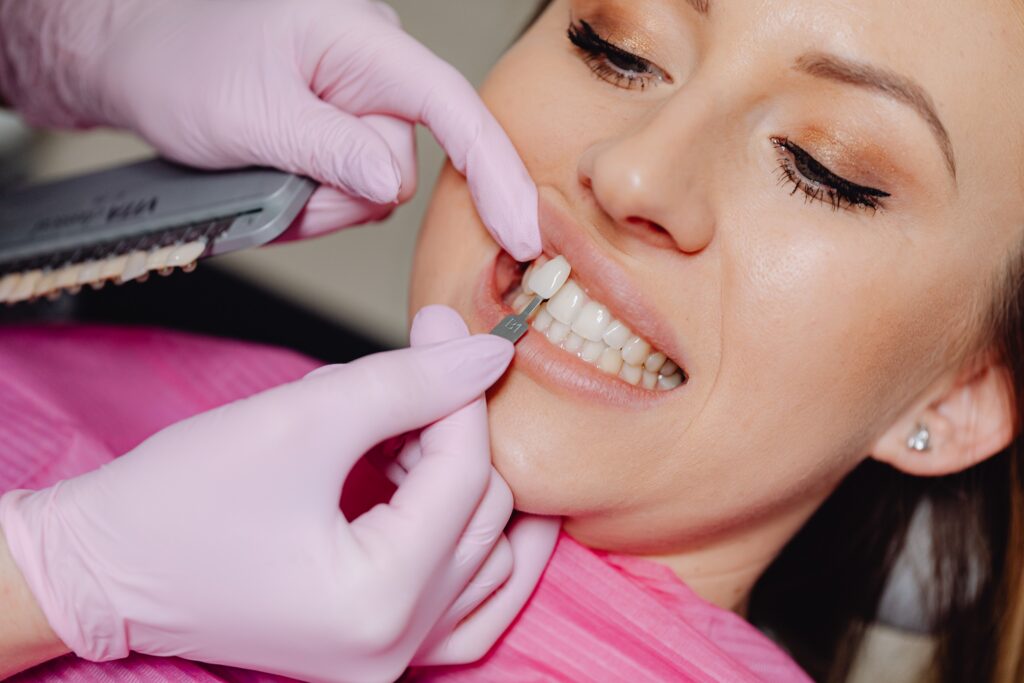 Close-up of a dental veneer being applied to a woman's teeth at a clinic.
